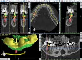 cbct-3d-scans