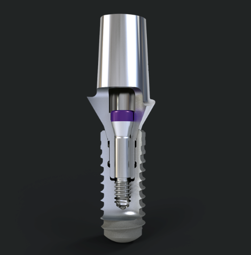 implants-crowns