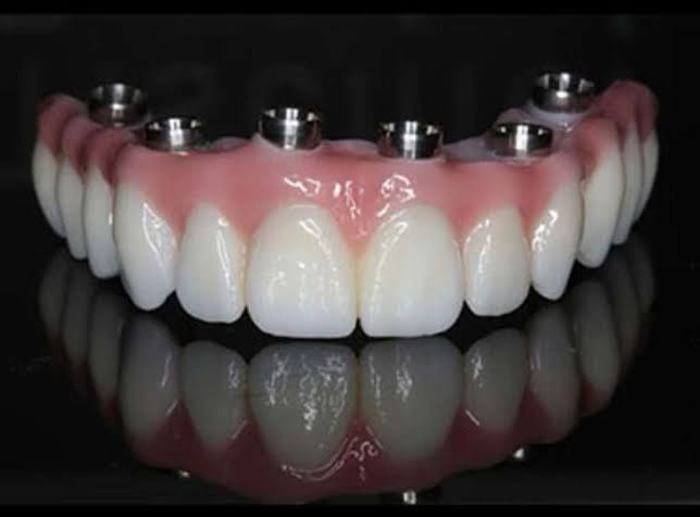 prosthetic-precision