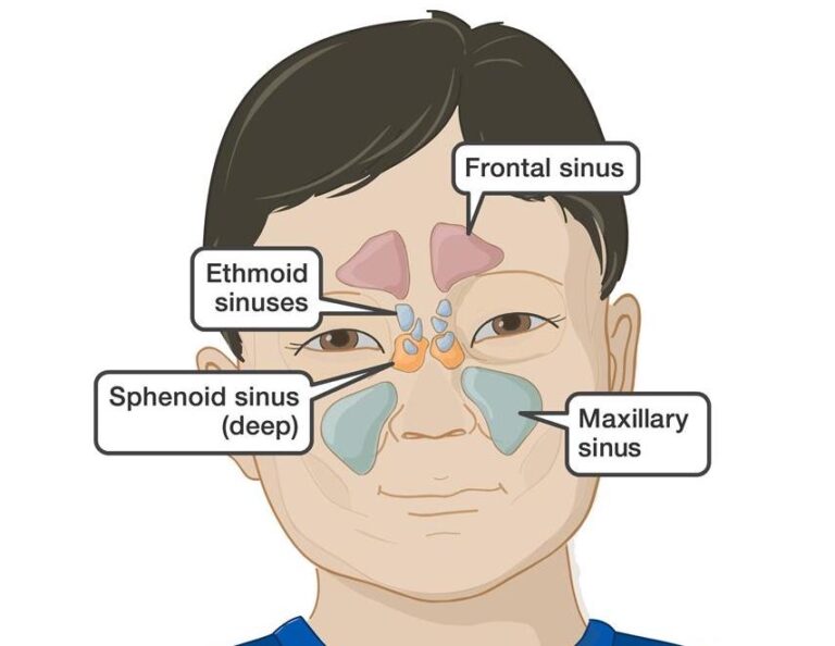 Tooth Pain & Sinusitis ( Mis Diagnosis ) Chapter2 Dentistry and